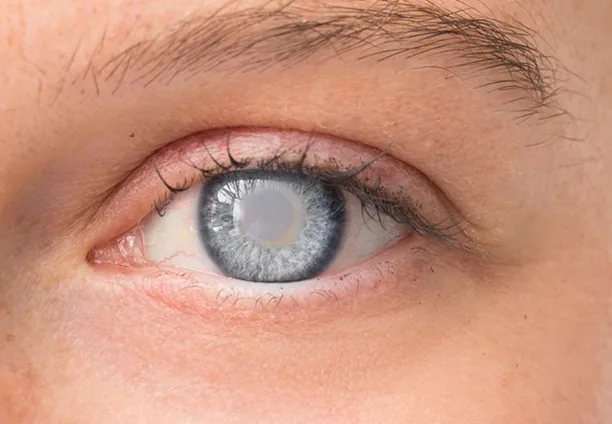 Retina and vitreous evaluation at MedEx Hospitals